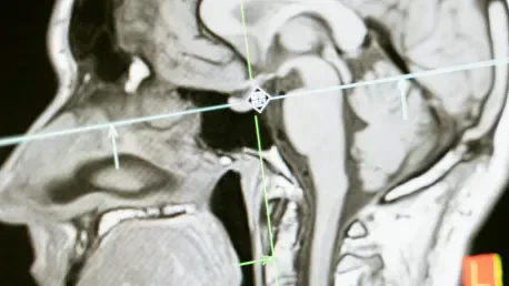 How Is AI Revolutionizing Radiation Dose Management?