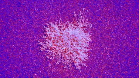RaySearch and ROS Revolutionize Precision Oncology Market