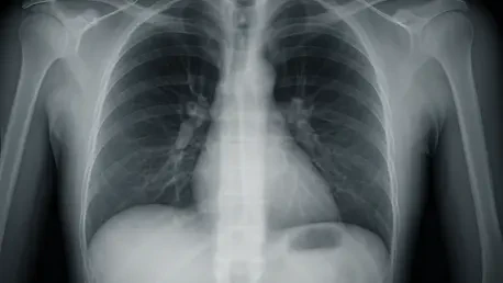 How Is 4DMedical Redefining Lung Imaging with CT:VQ?