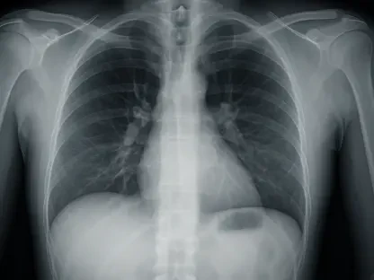How Is 4DMedical Redefining Lung Imaging with CT:VQ?
