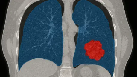 Can D-S-Net Revolutionize Lung Cancer Tumor Segmentation?
