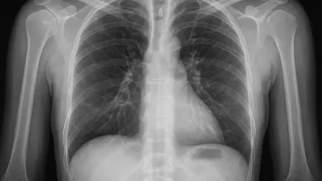 AI Surpasses Radiologists in Detecting Hidden Chest Objects
