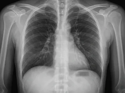 AI Surpasses Radiologists in Detecting Hidden Chest Objects