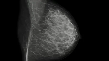 SimonMed Launches AI Platform to Boost Mammogram Follow-Ups