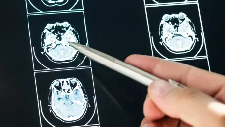 Fast Imaging Saves Brain Tissue in Stroke Patients