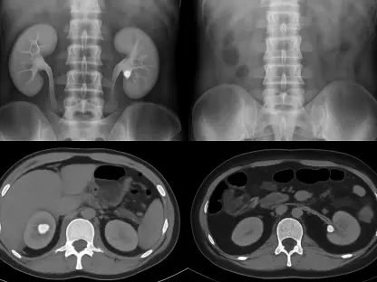 Are Kidney Stone Scans Unnecessarily Risky?