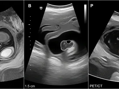 Ultrasound Matches MRI and PET/CT for Cervical Cancer Nodes