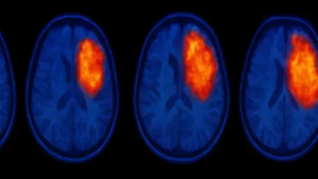 Does BBB Leakage Affect the Accuracy of Glioblastoma PET Scans?