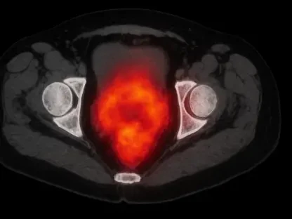 PSMA PET/CT Finds Aggressive Prostate Cancer Where MRI Fails
