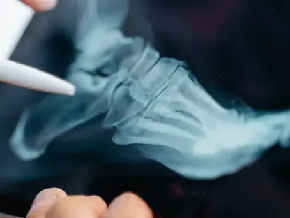 Can AI Help Radiologists Read Complex Heel X-Rays?